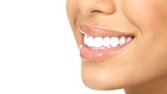 Как можно отбелить зубы дома или у стоматолога