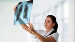 How often do x-rays