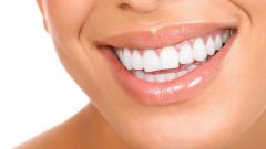 Как быстро отбелить зубы без стоматолога?