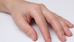 Проблемы с ногтями: к кому обратиться