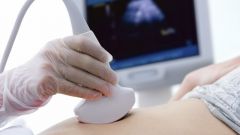 That will show the first ultrasound during pregnancy
