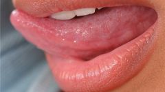 How to treat inflammation of taste buds 