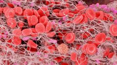 Why are blood clots and how to avoid it