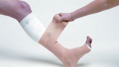 How to bandage the legs with varicose veins