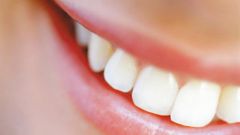 Правильный уход за зубами - что нужно знать?