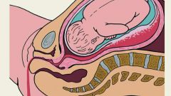Как рассасывается гематома при беременности