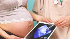 Как гинекологи смотрят  беременных