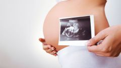 Как уменьшить тошноту при беременности