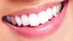 Как сделать красивыми зубы и сохранить привлекательную улыбку