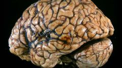 Как выглядит мозг человека