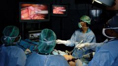 Under what anesthesia is being done laparoscopy