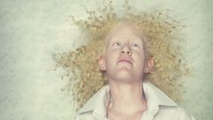 Почему рождаются люди альбиносы