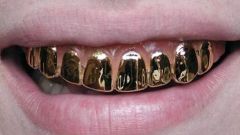 Где и когда появилась мода на золотые зубы 