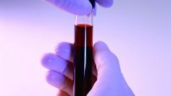 Биохимический анализ крови: нормальные показатели 