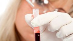 What kind of diseases can be recognized by blood and urine tests