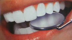 Как ухаживать за съемными зубными протезами