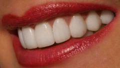 Как отбелить зубы самостоятельно и сохранить эмаль