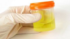 How to collect a urine sample for Sulkowice 
