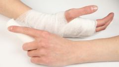 What painkillers relieve pain in the broken arm 