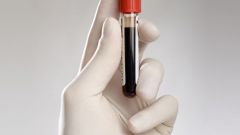 How to pass a blood test for cortisol 