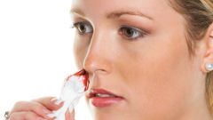 Кровь из носа: возможные причины и лечение