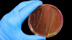 Escherichia coli in a smear: how serious is it