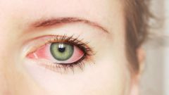 Как лечить воспаленные глаза
