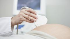 Why ultrasound is mistaken in determining the sex of the child