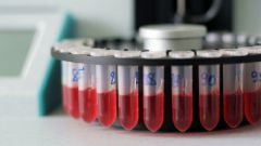 Может ли анализ крови показать рак