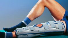 Как лечить гемартроз коленного сустава