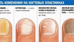 Diagnosis of the body through nails