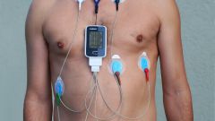 Rules of preparation for monitoring by the method of Holter