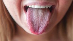 Почему появляется белый налет на языке у взрослых