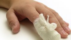 Что делать, если нарывает палец — методы лечения