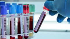 РМП анализ крови: что это такое, расшифровка, как сдавать