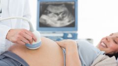 Доплер УЗИ при беременности: что это такое, описание 