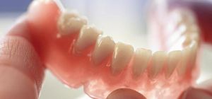 Что такое покрывной зубной протез
