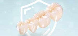 Какие есть тонкости выбора и разновидности зубных коронок