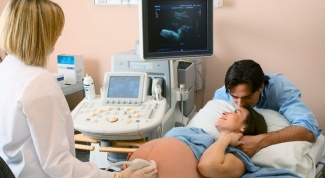 How to determine the fetal heart rate
