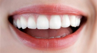Как выровнять передние зубы