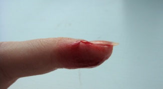 Как остановить кровь из пальца