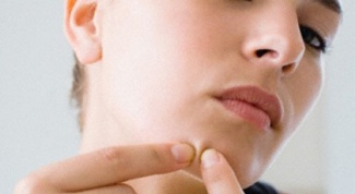 Угревая сыпь: как убрать ее с лица