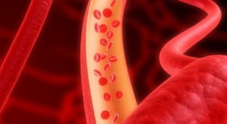 How to diagnose atherosclerosis