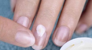 How to get rid of fungus on fingernails