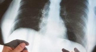 How to distinguish bronchitis from pneumonia