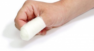 Как лечить панариций на пальце
