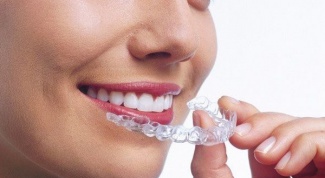 Как выпрямить передние зубы