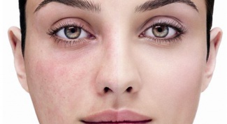 How to get rid of spider veins on the face
