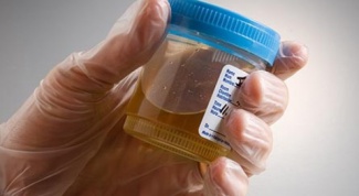 How to collect urine for analysis
