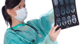 Томография в диагностике опухолей головного мозга